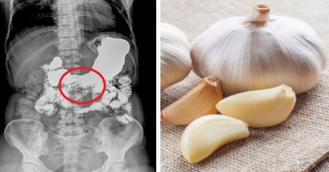 see-what-happens-when-you-eat-garlic-on-an-empty-stomach