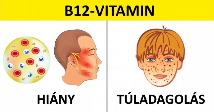6 hasznos tudnivaló a vitaminbevitelről